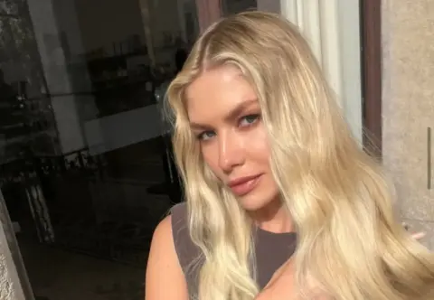 lena perminova recovers from severe skin burn after beauty mishap