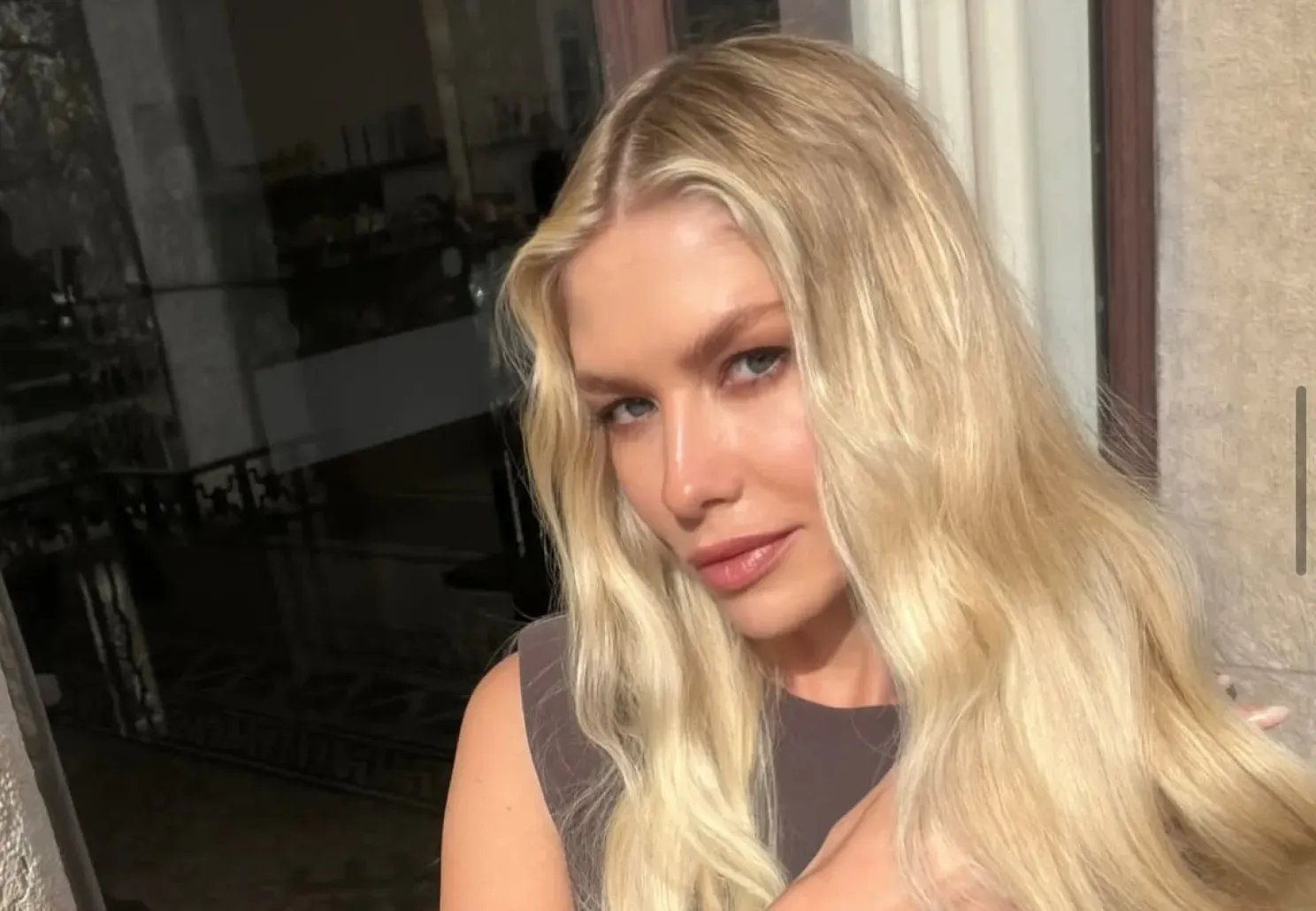 Lena Perminova Recovers from Severe Skin Burn After Beauty Mishap 19 lena perminova recovers from severe skin burn after beauty mishap